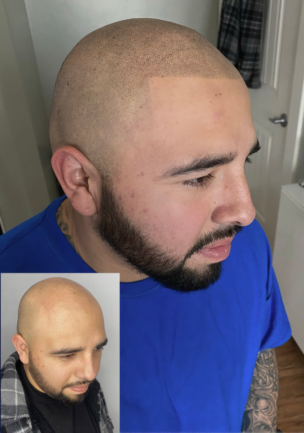 SMP before and after - density